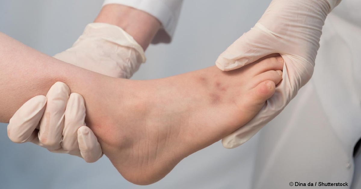 Боль в ногах: почему бывает и как облегчить?