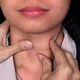5 эффективных натуральных способов от боли в горле 