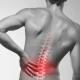 Медики напомнили о важности своевременного выявления остеопороза